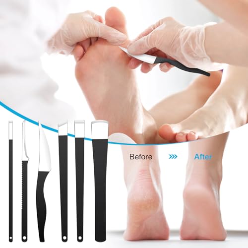 6Pcs Pedicure Knife Set, Professional Foot Knife with A Storage Box, Ingrown Toenail Removal Kit, Foot Care Tools Hard Dry Skin Remover for Hand Feet