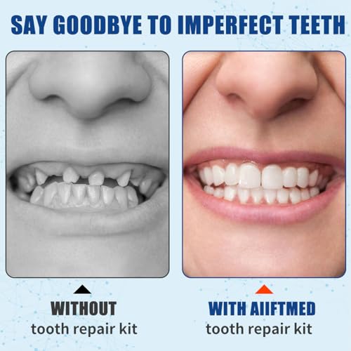 Tooth Repair Kit, Temporary Teeth Replacement Kit, Zinc Oxide Eugenol Cement Dental Kit for Broken Chipped Teeth, Missing Teeth, Crown Fillings & Bridges, Improving Smile 4 Pcs