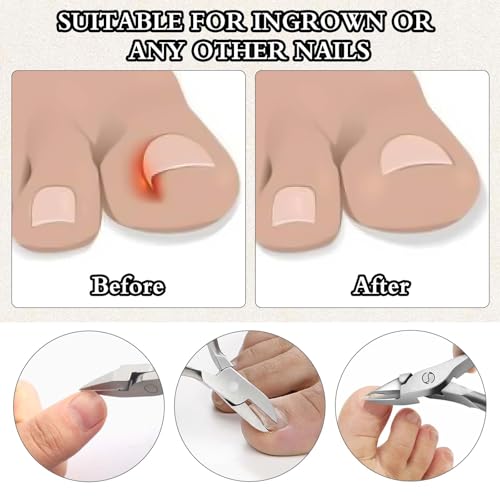 Stainless Steel Ingrown Toenail Clipper