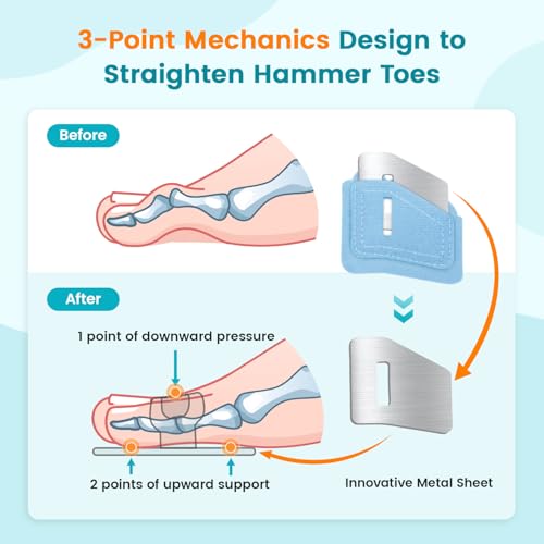 Hammer Toe Straightener Corrector Splint Brace for Women fit 2nd 3rd and 4th Toes - (L-Blue) - 1 Pair L Blue