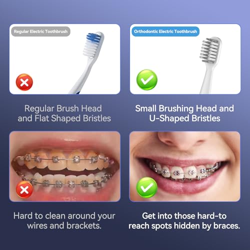 JTF Orthodontic Electric Toothbrush for Braces with 6 U-Shaped Brush Heads