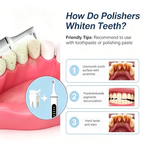 Tooth Polisher,Teeth Polishing Kit for Daily Cleaning,Polishing Then Whitening of Tooth USB Rechargeable Dental Polisher with LED Light,7 Heads,5 Speed Modes
