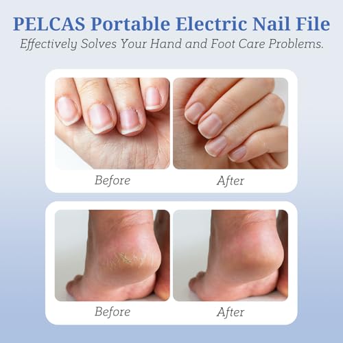 PELCAS Electric Nail File, Manicure and Pedicure Kit 5 Speeds & LED Light Silver