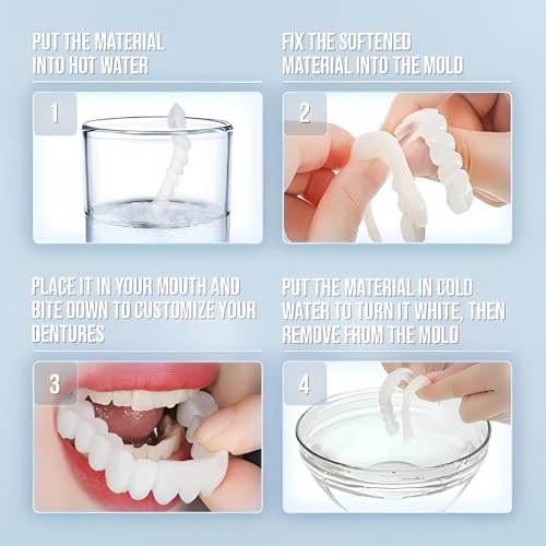 2 Pairs of Smile Adjustable Supports Unisex for Temporary Use to Quickly Restore Self-Confident Smiles