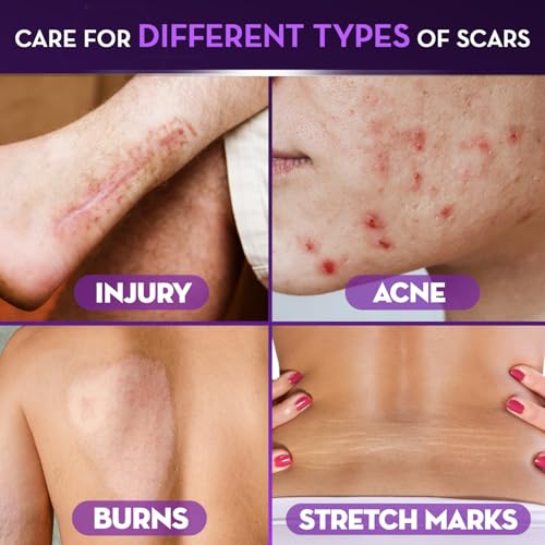 Cicatricure Advanced Scar Gel, Proven Results in 2 Weeks, 2 oz (56 g) 2 Ounce (Pack of 1)