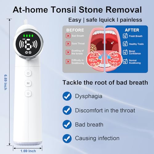 Upgraded Tonsil Stone Remover Tool – Rechargeable Tonsil Stone Vacuum with LED Light & 11-in-1 Probes, for Bad Breath Relief, Safe Silicone/Glass Tip for Tonsilloliths Removal OFF-White