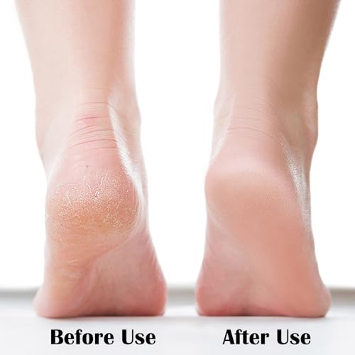 Nano Foot File, Foot Scrubber Callus Remover, Foot Care Pedicure Tool, Foot File with Nano-Level Grinding Points, Portable Foot Scrubber for Dead Skin Removal, Cracking, Wet and Dry Feet