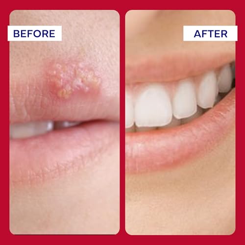 EMUAIDMAX First Aid Ointment for Eczema-Prone, Dry & Itchy Skin, 0.5 oz 0.5 Ounce (Pack of 1)