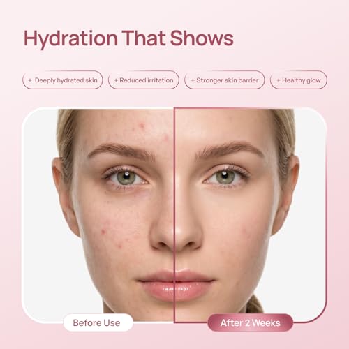 PLANTIFIQUE Korean PDRN Milky Toner for Face – Glass Skin & Barrier Repair