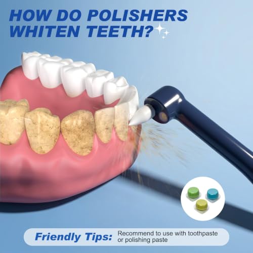Tooth Polisher, Tooth Whitening Kit for Teeth Cleaning and Whitening Blue 1 Count (Pack of 1)