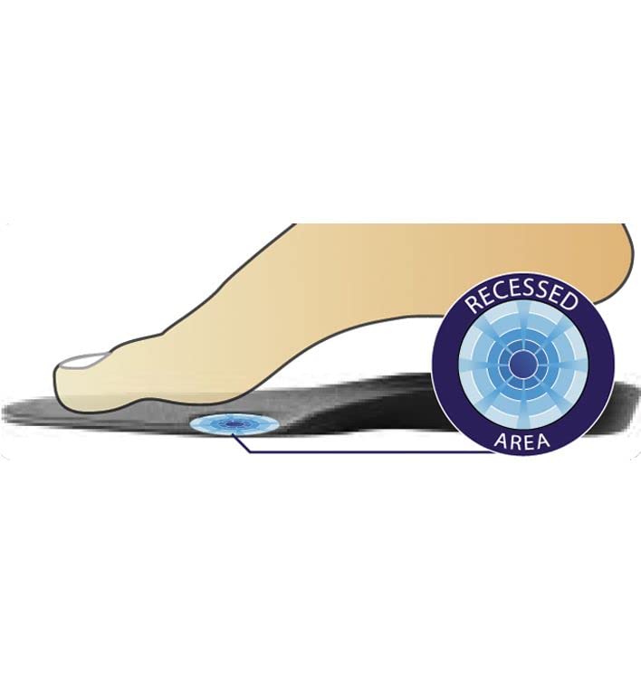 DonJoy Arch Rival Orthotic Inserts, 1 Pair, Size D (Shoe Size: Men's 9.5-11 / Women's 10.5-12), Black D (Shoe Size: Men's 9.5-11 / Women's 10.5-12) - BeesActive Australia