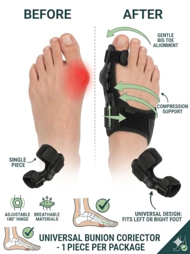 Bunion Corrector for Women and Men – Professional Big Toe Straightener & Hallux Valgus Relief Splint – Adjustable Bunion Pads & Toe Spacers for Pain Relief, Day & Night Support For Both Feet.