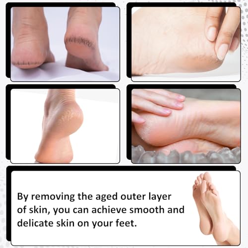 Stainless Steel Foot Scraper, Double-Sided Foot Rasp Metal-Foot-File Feet Grater Feet Callus Remover Tool Callus Remover Heel Scrubber for Wet and Dry Skin