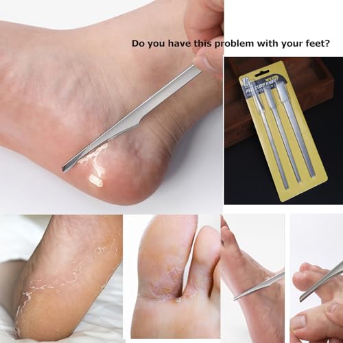 Stainless steel ingrown toenail pedicure knife set,professional foot skin scraper repair sharp blade kit for nail corn callus paronychia treatment. (3), Silver