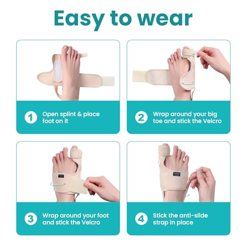 Promifun Bunion Corrector for Women & Men - 1 Pair Adjustable Toe Splint for Broken Toe - Pain Relief Support Brace & Straightener with Non-Slip Strap(Beige) Beige
