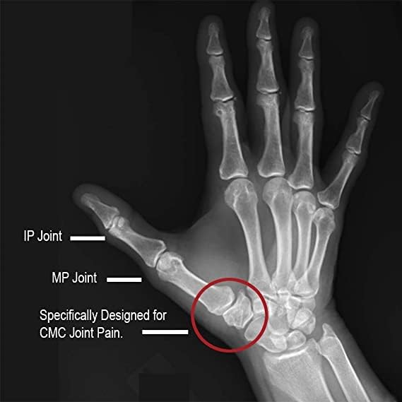 Comfort Cool Thumb CMC Restriction Splint, Right Medium 7" to 8" Black - Right Medium (Pack of 1)