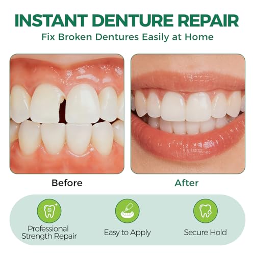 Dental Lab Instant Bonding, Professional Denture Repair Adhesive Kit, Fast Setting in 1 Min, Fix Broken Dentures &Retainer at Home, Strong Dental Adhesive Glue with Tools (10ML) Denture Use