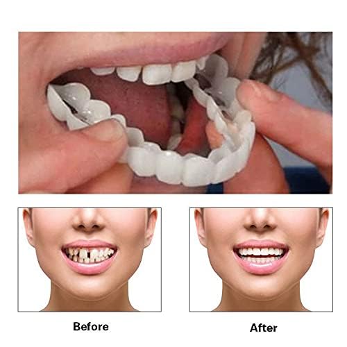 Temporarily Adjustable Kit, Nature and Comfortable 2 Pairs for Women and Men (5.0) 5.0