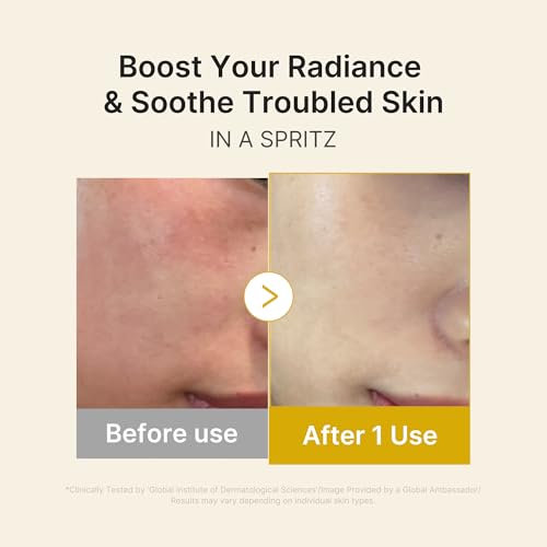 medicube Jelly Mist Serum with Kojic Acid Turmeric, 2.02 fl.oz 2.02 Fl Oz (Pack of 1)