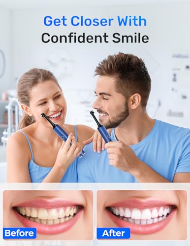 Rechargeable Tooth Polisher, Teeth Polishing Kit for Teeth Whitening, Tooth Polisher for Tartar Stain Removal, Teeth Cleaner Tools for Home Use with 3 Polish Paste and 5 Brush Heads, LED Light