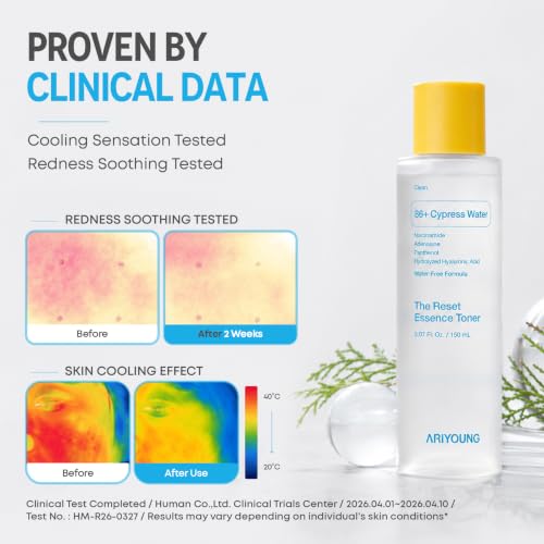 Reset Essence Toner, Hydrating Face Toner with 86% Hinoki Cypress Water for Dry & Sensitive Skin, Oligo Hyaluronic Acid, Panthenol, Korean Skincare, 5.07 fl oz