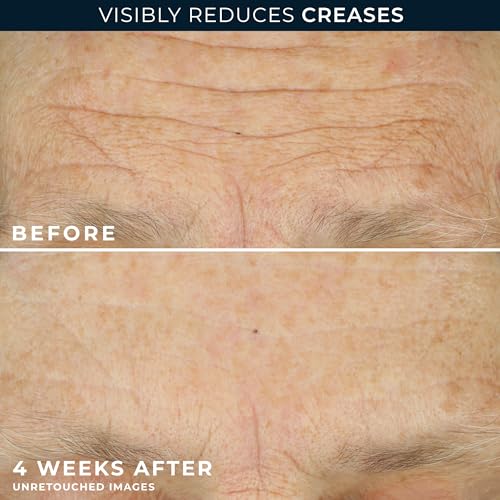 RoC Crepe Repair Face & Neck Firming Cream 1.7oz, Retinol + Hyaluronic Acid 1.7 Fl Oz (Pack of 1)