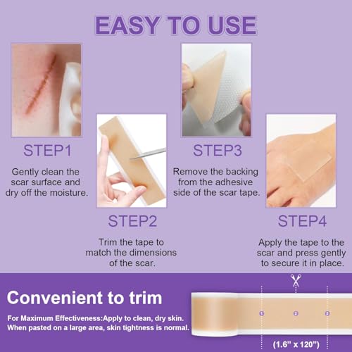 Silicone Scar Sheets, Medical Grade Silicone Scar Tape (1.6" x 120"), Professional Scar Removal Treatment, Reusable, for Healing Keloids, Surgeries Scars, C-sections, and Burns 1.6" x 120"