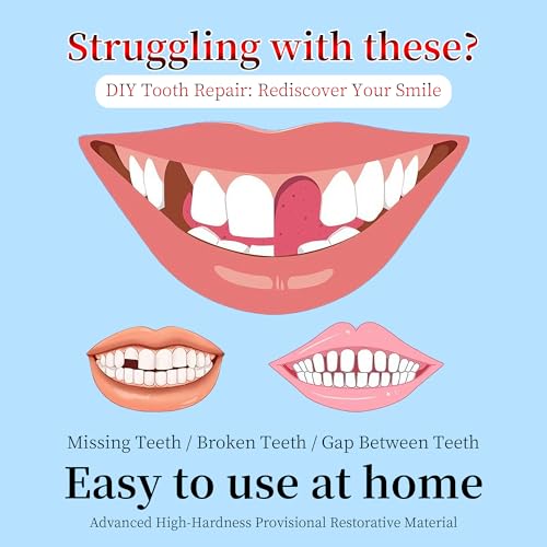 Dental Repair Kit for Gaps, Chips, Missing Teeth & Cavities - High Hardness Temporary Filling, Light Cure, Heat Resistant, DIY at Home with Tools, Natural Looking