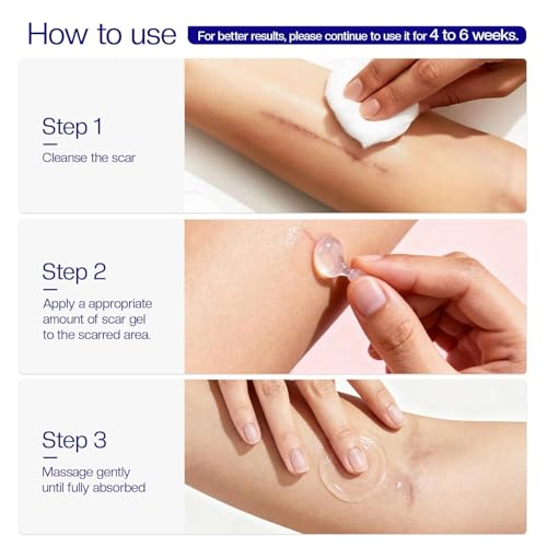 Morovan silicone scar removal Gel: Scar cream for Body and face Effectively minimizes the appearance of Scars from Stretch Marks Surgical Scar Keloids Acne Burns and Other, New scar 6 weeks