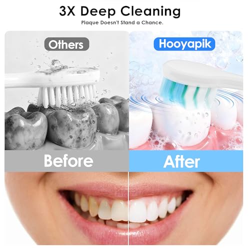 38000 VPM Sonic Electric Toothbrush Set with 6 Brush Heads-2 Minute Timer-4 Cleaning Settings，IPX7 Waterproof,Lightweight and USB Rechargeable Toothbrush for Oral Care (White) White