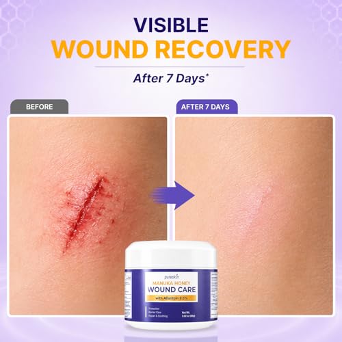 PURESKIN Manuka Honey Wound Care 2 Pack: Manuka Honey Wound Gel for Cuts, Scrapes & Burns with Allantoin 0.5% & Tallow - Natural-Inspired Moisturizing Formula - 2.82 oz Each 2.82 Ounce (Pack of 2)