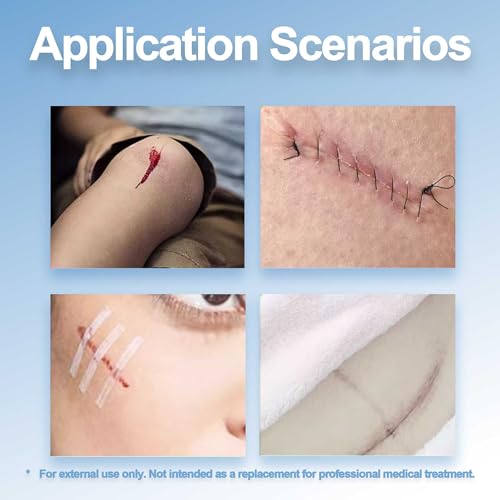 Sterile Reinforced Wound Closure Strips | 12x100mm | 20 Packs | 120 Strips