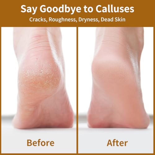 Nano Glass Foot File, Double-Sided Foot Callus Remover for Cracked Heels Black