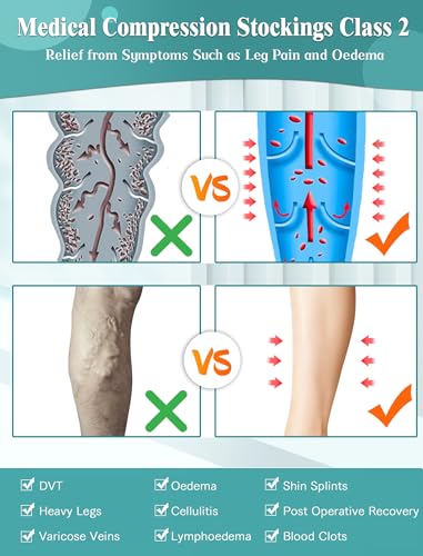 Medical Compression Tights for Women 20-30mmhg,Compression Stocking L Black+Beige