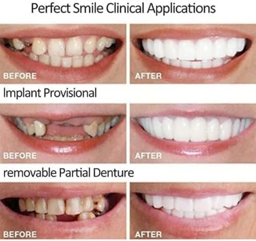 2 Pack Wearable Smile Cover, Bendable Teeth Accessory for Daily Social Gathering (Ivory White, b) Ivory White 1 Count (Pack of 2)