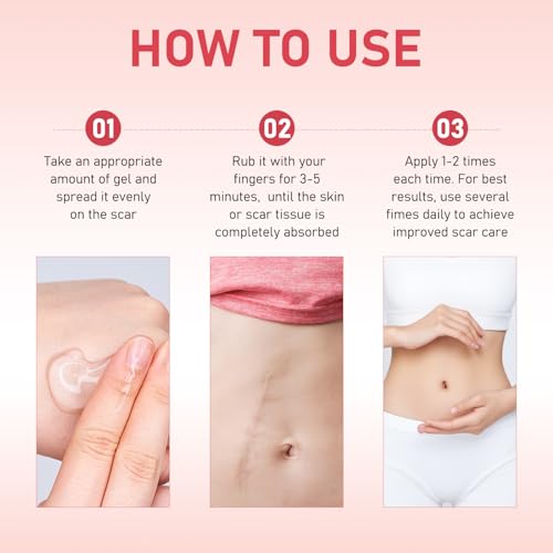 Scar Soothing Cream & Smoothing Cream for Scars,Improve scars （2 PCS）
