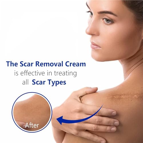 Advanced Scar Gel for Surgical Scars, Face, Body, Legs, Burns, Acne, C-Section, Stretch Marks, Keloids - Effective Scar Removal for Men and Women, Suitable for Old & New Scars (100% New -1 Bottle) 100% New -1 Bottle