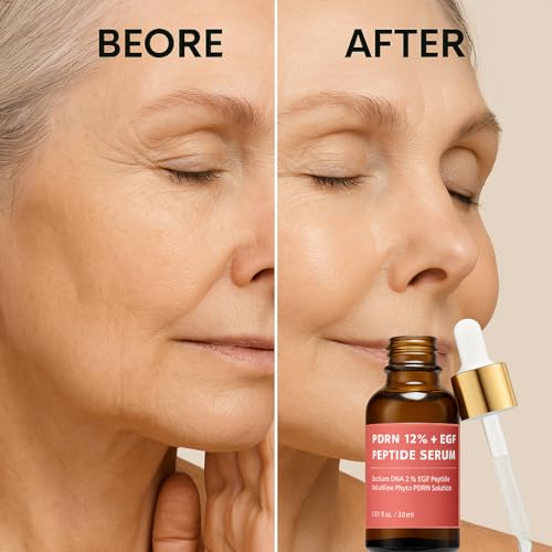 Salmon DNA PDRN 120,000 ppm EGF Peptide Serum & Cream Set w/Volufiline, Phyto PDRN 12%, Growth Factor – Anti-Aging Face Serum & Facial Cream with Niacinamide, Hyaluronic Acid – Korean Skincare Duo PDRN 12% DUO