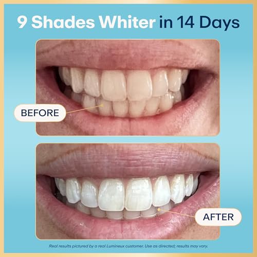Lumineux Whitening Duo, 2pk 10% nHA Toothpaste 3.75 oz + 9 Whitening Strips 2 Count + 1 Month Supply Strips