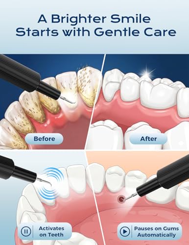 Ultrasonic Plaque Remover for Teeth - Dental Tartar Remover with LED Light, 4 Modes Rechargeable Teeth Cleaning Kit, Electric Dental Calculus Remover with 3 Stainless Steel Heads for Home & Travel Black