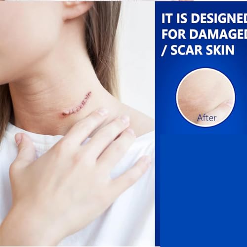 Advanced Scar Gel for Surgical Scars, Face, Body, Legs, Burns, Acne, C-Section, Stretch Marks, Keloids - Effective Scar Removal for Men and Women, Suitable for Old & New Scars (100% New -1 Bottle) 100% New -1 Bottle