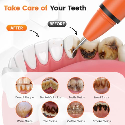 Plaque Remover, Electric Teeth Cleaner with 4 Tips