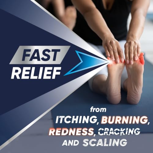 Lamisil Athletes Foot Spray, Antifungal, 1 Week Foot Fungus Treatment, Prescription Strength Terbinafine, Relieves, Treats & Prevents Recurrence, 4.2 oz (120 g)