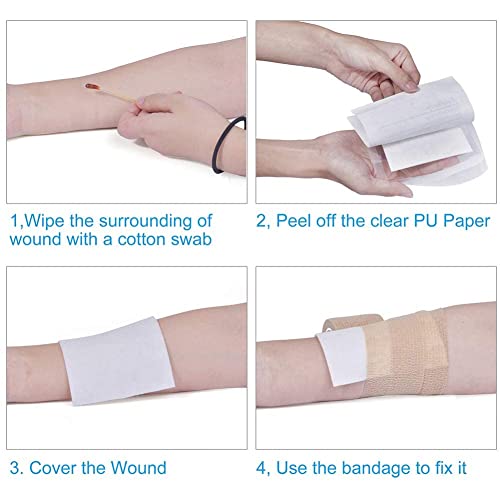 10PCS Calcium Alginate Wound Dressing Pads, 4.25"x 4.25" and Emergency Wound Closures Laceration Repair Kits 4-Count Bundle