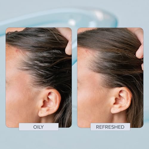 TRUHAIR Head Start Scalp Ampoule | Multi-Action Exfoliating & Nourishing Scalp Treatment | Salicylic Acid, Black Willow Bark & Biotin | Soothes, Hydrates & Reduces Flakes | 150ml/ 5.07 fl oz