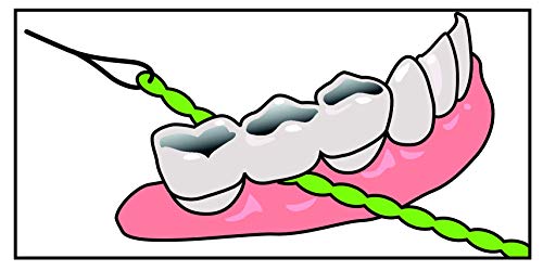 IDontix Brace X-Floss, Green