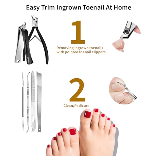 EBEWANLI Ingrown Toenail Removal Kit, 6-Piece Black-6pcs