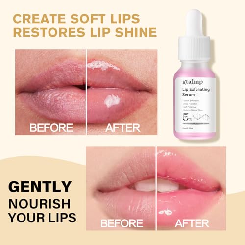 PHA 5% Exfoliating Lip Serum - Gentle Overnight Treatment for Dry, Flaky Lips, Hydrating Lip Exfoliator & Primer for Smoother, Softer & Plump-Looking Lips (1) 1