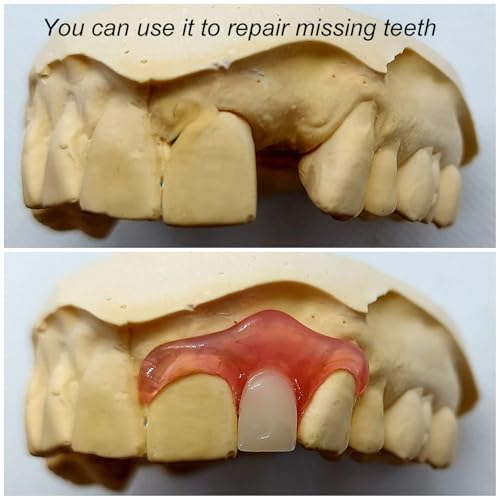 Gum Material - for Repairing Missing Teeth and Smile Improvement. Parts of Partial or Full Dentures