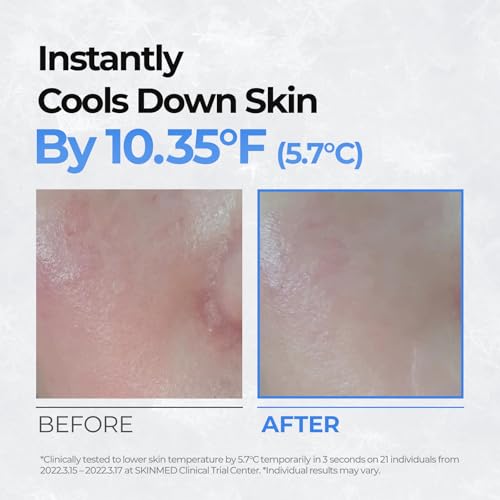 Cell Fusion C Post Alpha Cooling Pad – Hydrating & Cooling Korean Toner Pads | Panthenol & Glacier Water | Hydrating, Depuffing, Pore Care | 70 Pads / 6.08 fl.oz.